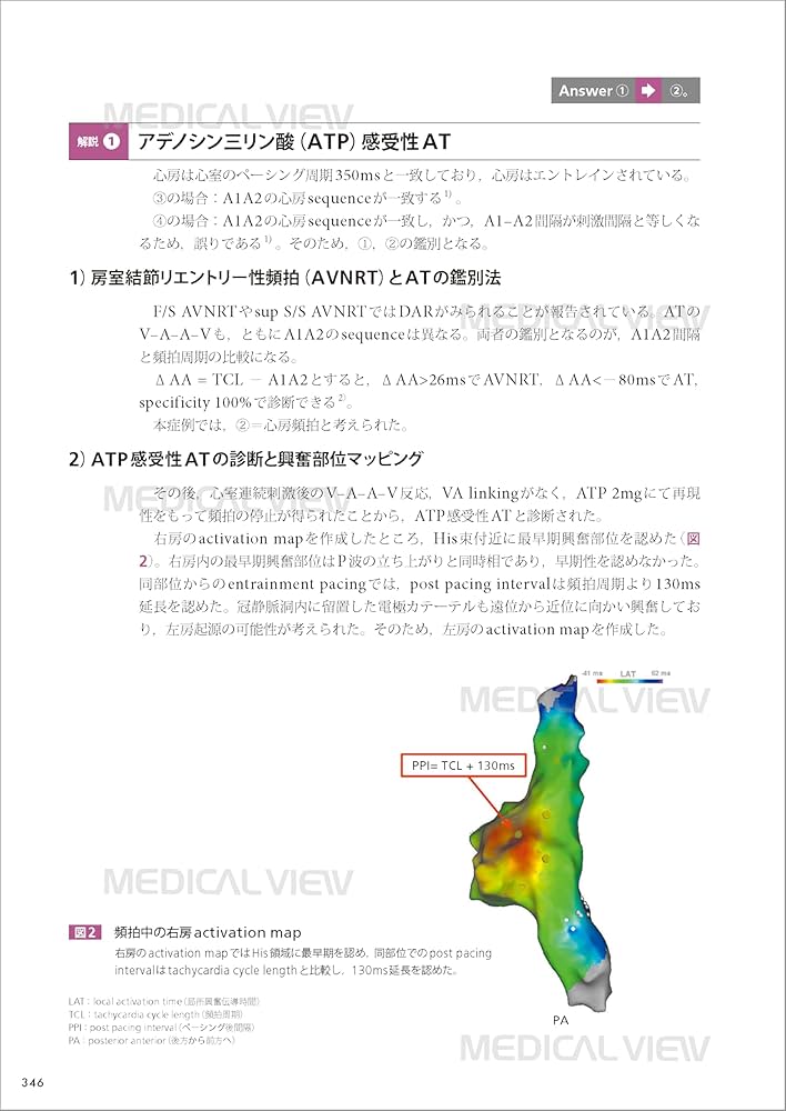 【裁断済】カンファレンスで学ぶ 心臓電気生理のすべて メジカルビュー社｜循環器内科｜カンファレンスで学ぶ 心臓電気
